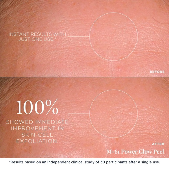 m-61 Power Glow Peel NEW IN BOX - Picture 4 of 11